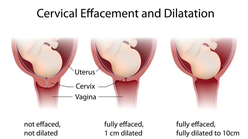Your Dilating Cervix – The Gateway to Baby's Birth